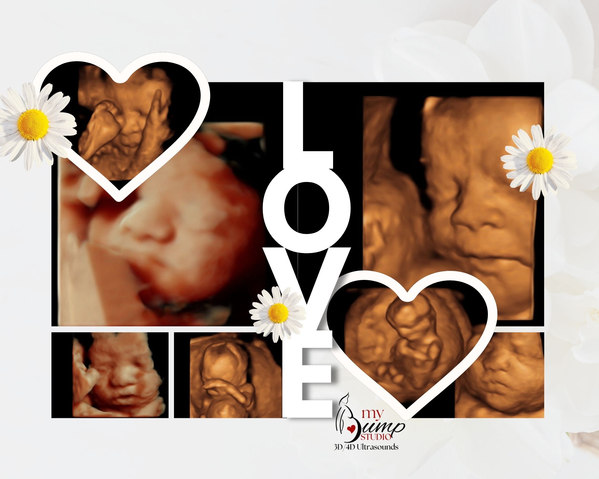 3D 4D ultrasound Birmingham Hueytown Center Point