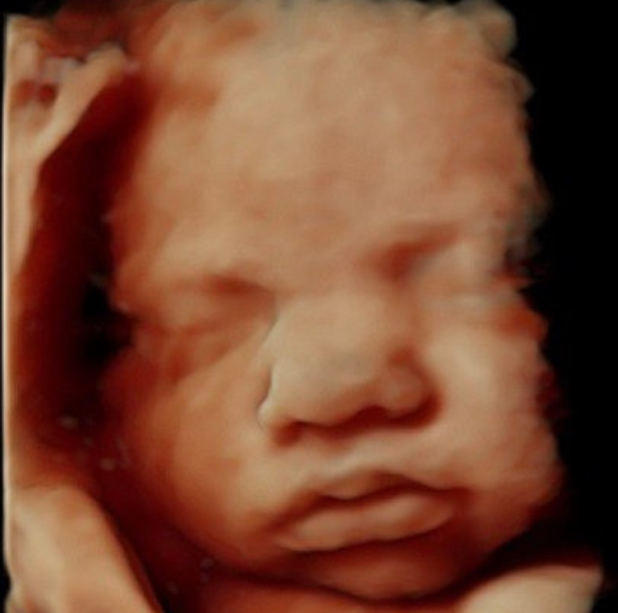 Pregnancy ultrasound keepsake images Birmingham Alabama