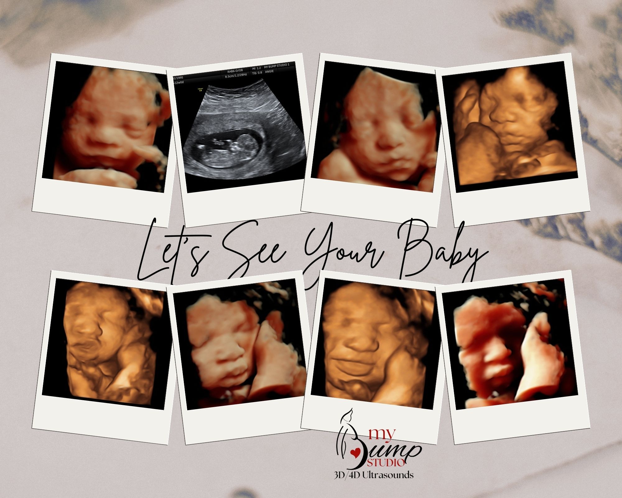4D ultrasound bonding experience My Bump Studio
