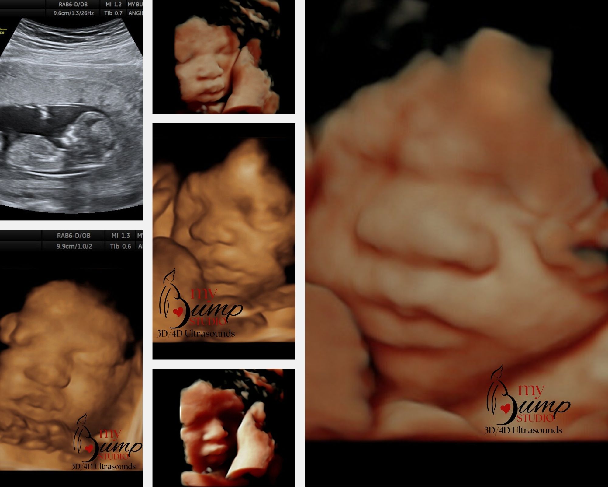 Baby ultrasound session My Bump Studio Center Point
