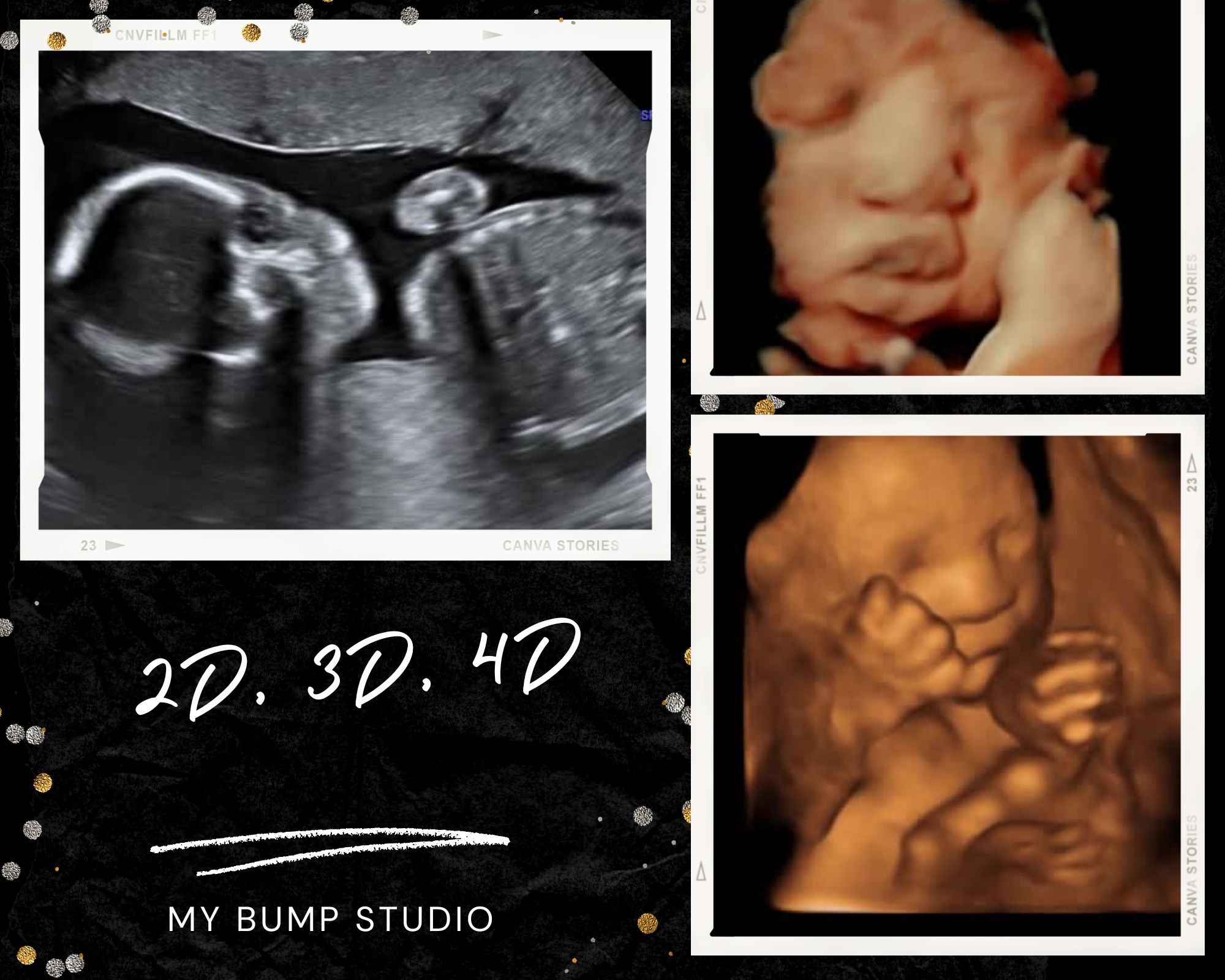 Pregnancy keepsake ultrasound images Birmingham Alabama