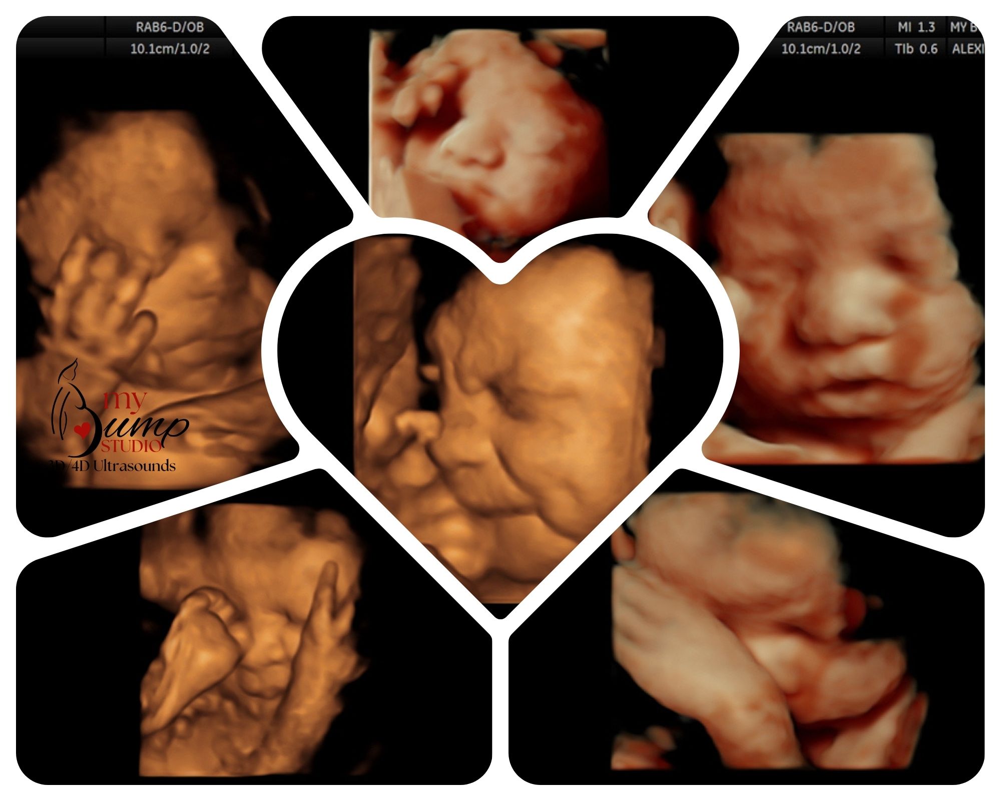 Pregnancy ultrasound keepsake images Birmingham Alabama