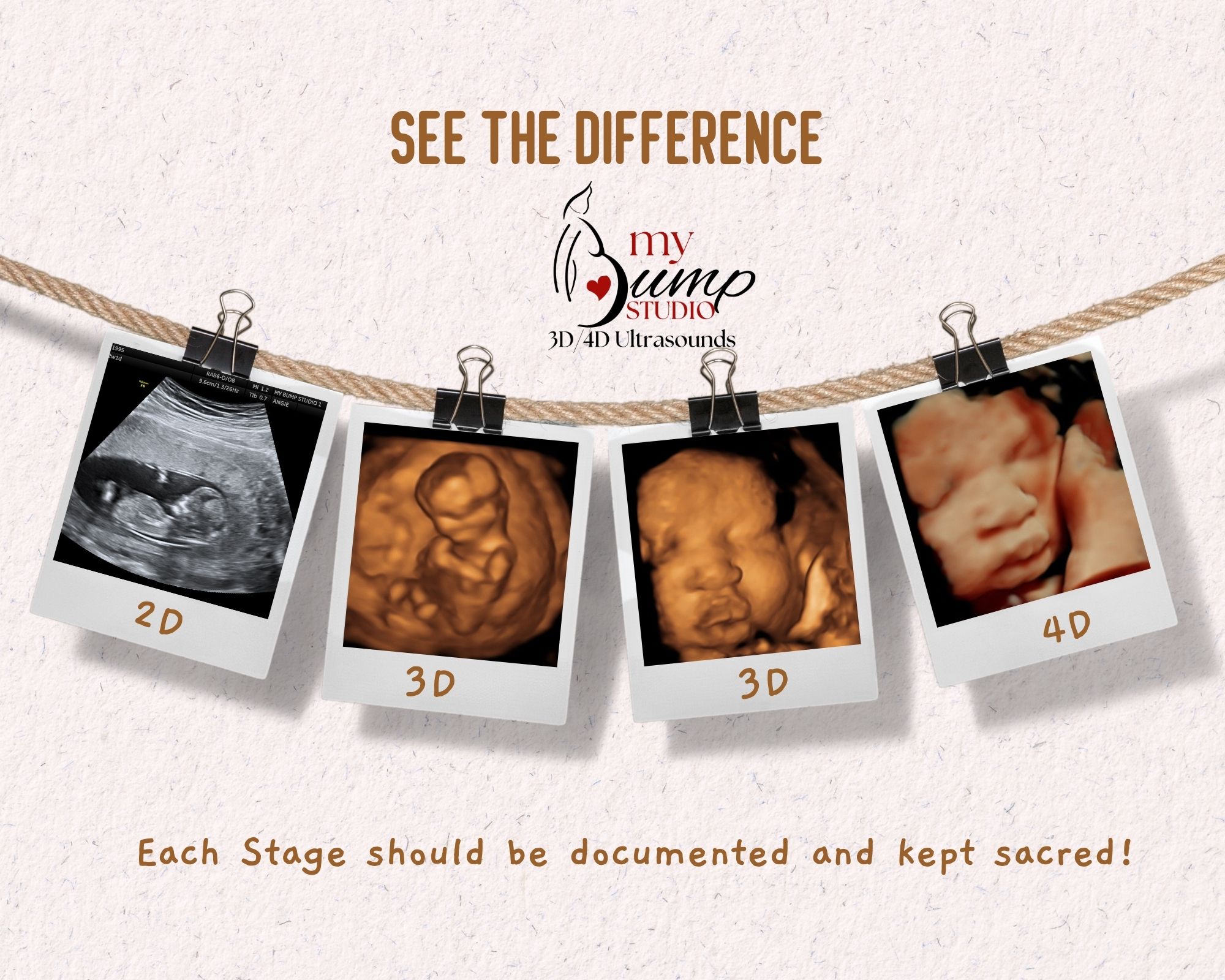 Baby ultrasound session My Bump Studio Birmingham