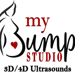 My Bump Studio 3D 4D ultrasound Birmingham Alabama