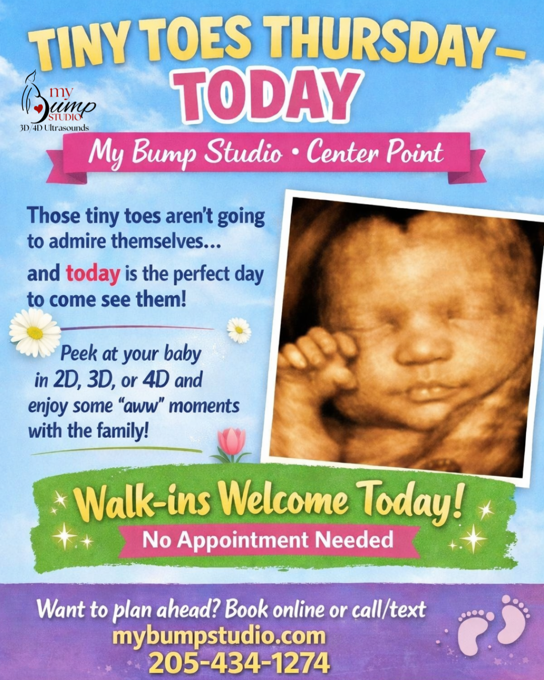 3D 4D ultrasound Center Point Alabama My Bump Studio