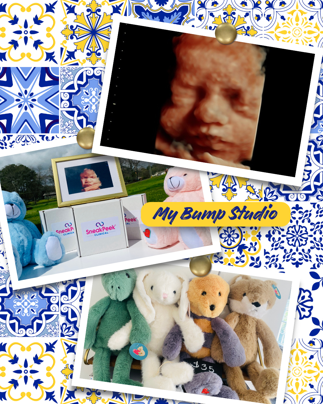 Gender reveal baby ultrasound session My Bump Studio Birmingham