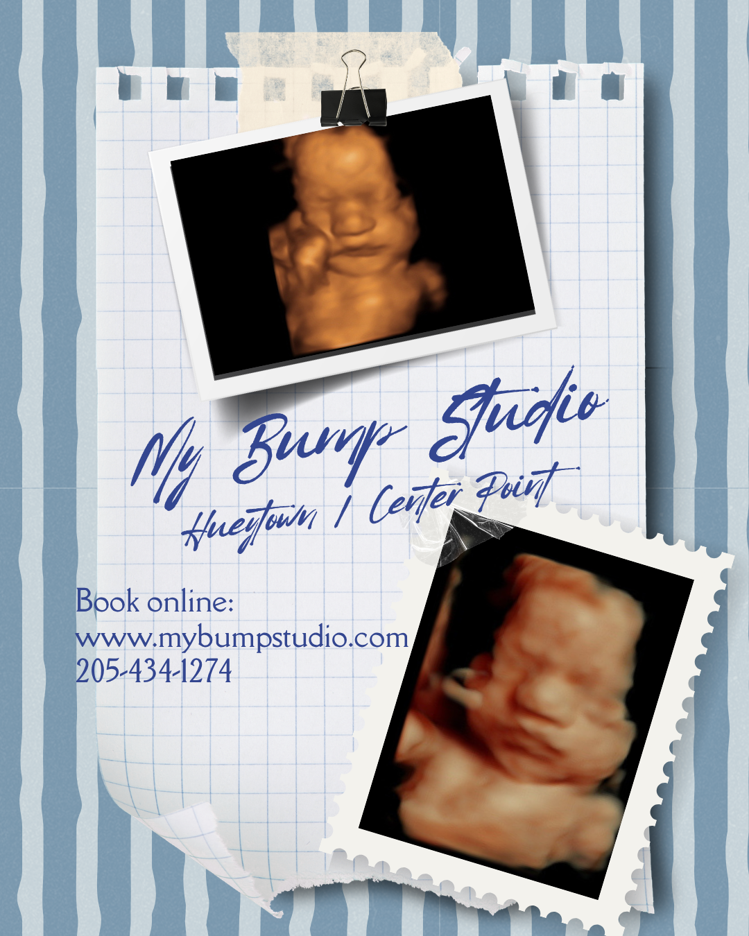 4D ultrasound Hueytown Alabama My Bump Studio