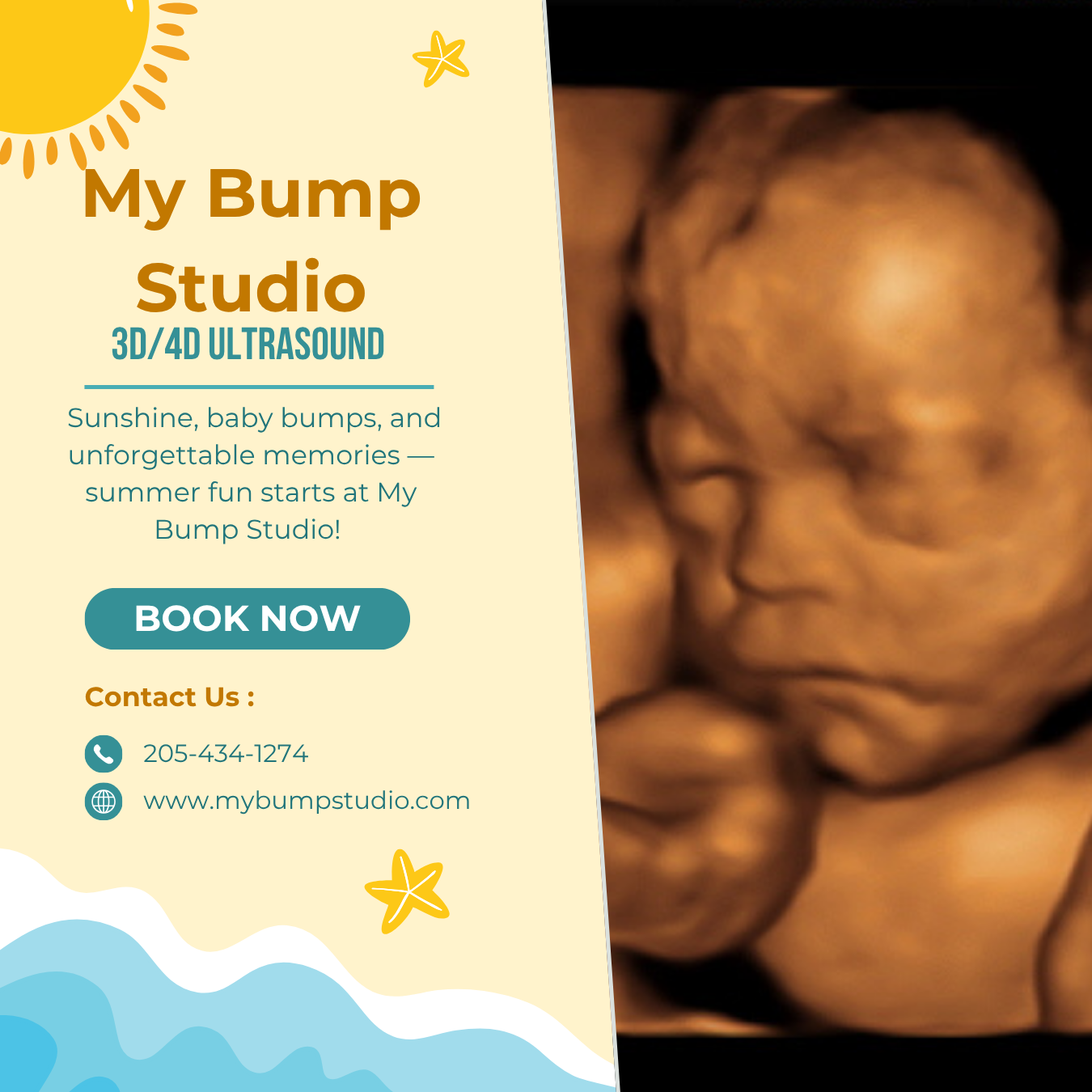 My Bump Studio Hueytown 3D 4D ultrasound location