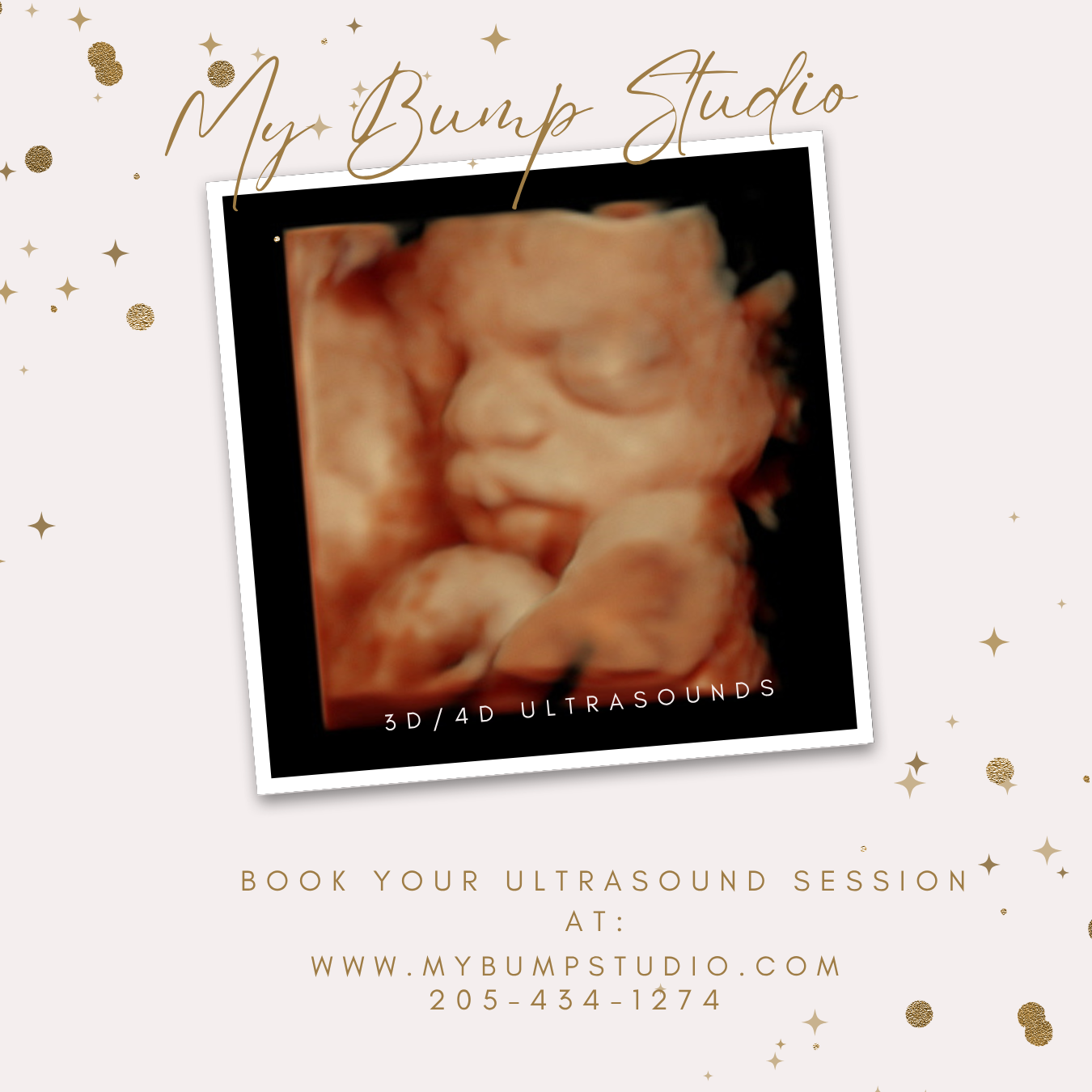 3D 4D ultrasound near Birmingham AL at My Bump Studio Hueytown