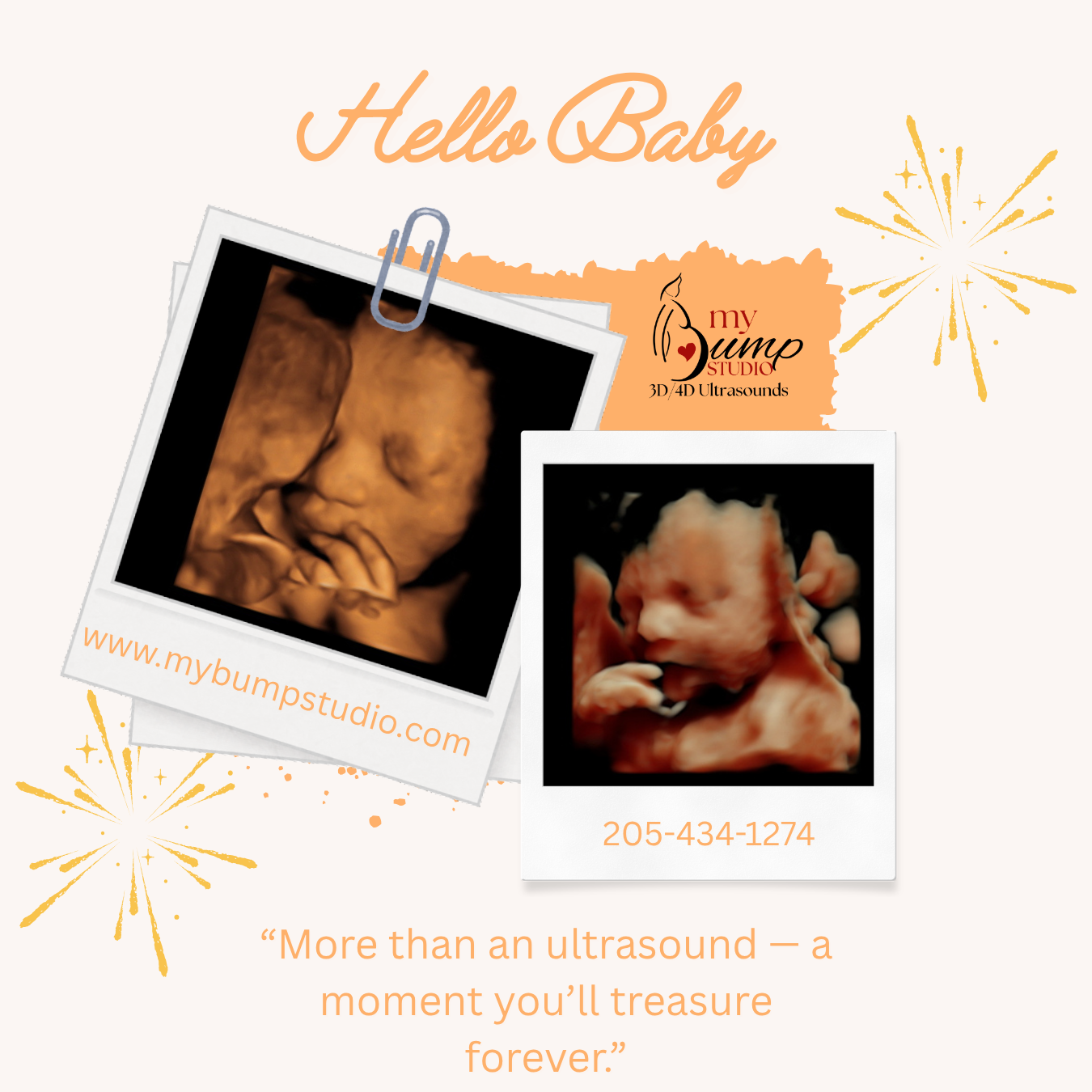 My Bump Studio Center Point 3D 4D ultrasound location
