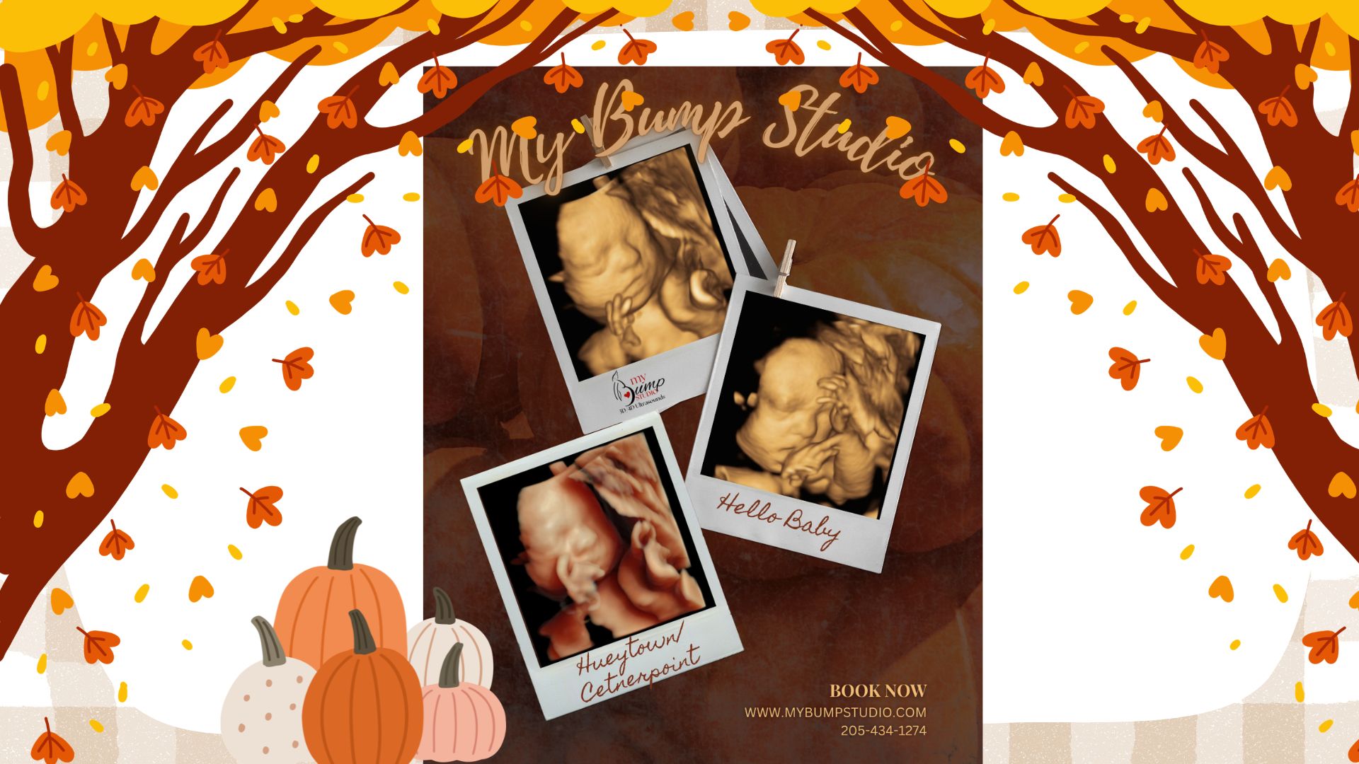 4D ultrasound baby face My Bump Studio Birmingham Alabama