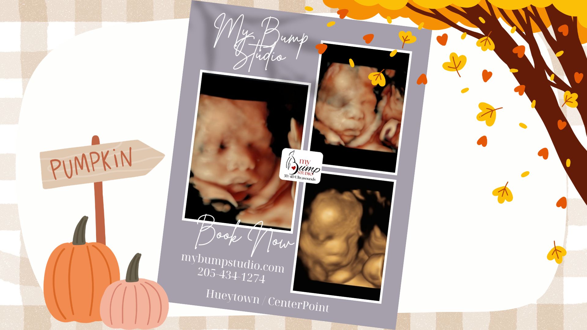 My Bump Studio pregnancy ultrasound experience Birmingham Alabama
