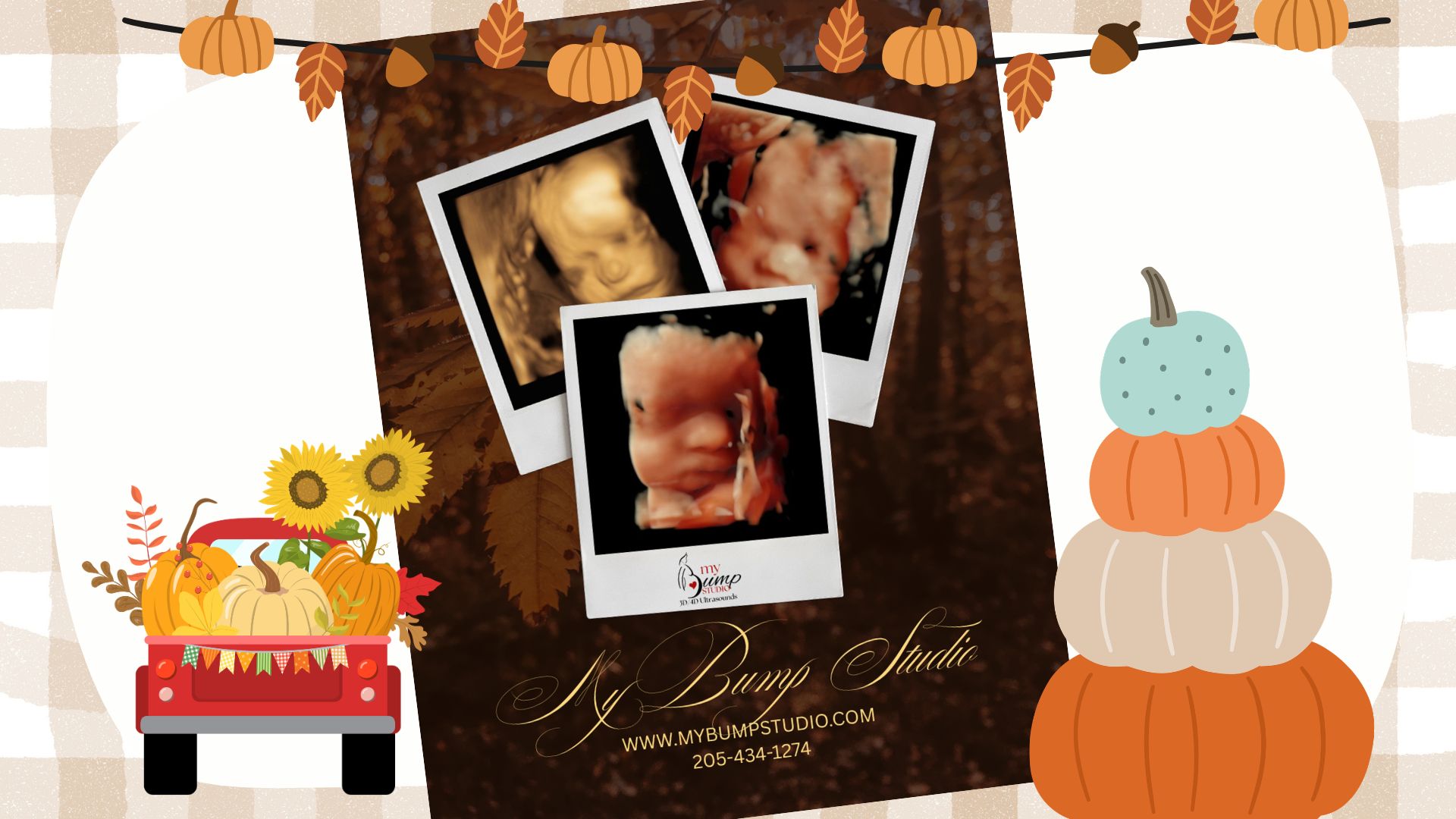 Pregnancy ultrasound keepsake image Birmingham Alabama
